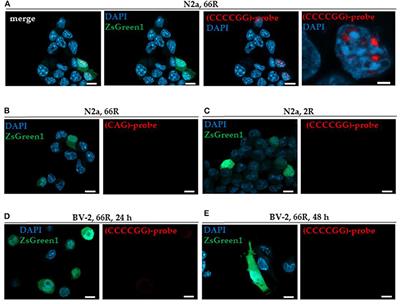 BV-2 Microglial Cells Overexpressing C9orf72 Hexanucleotide Repeat Expansion Produce DPR Proteins and Show Normal Functionality but No RNA Foci